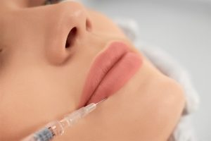 augmento-labios-acido-hialuronico-be-fabulous-madrid-centro-medico-estetico